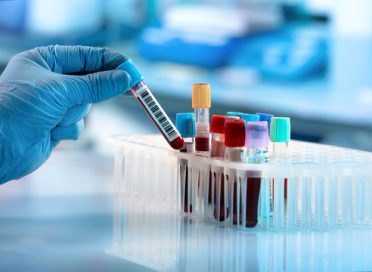 360_F_211045328_HnemU2NVFNwDWnQtDi5JHeHVhMV1jTOr